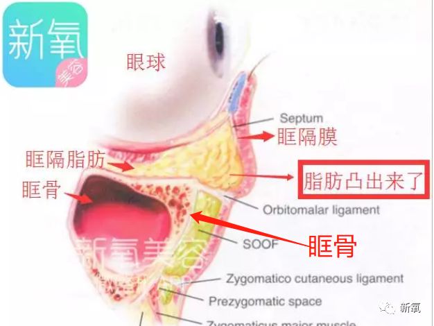 以为关晓彤是眼袋黑眼圈最重的90后女星 结果是她