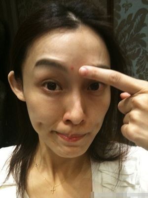 看范玮琪新婚如何去痘印(组图)