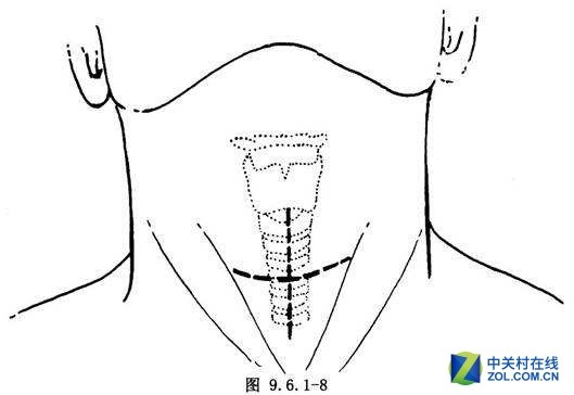 打鼾睡不好黑眼圈？那是因为没有呼吸机 