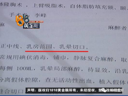 女子隆胸没达效果和丈夫离婚：摸起来没感觉了